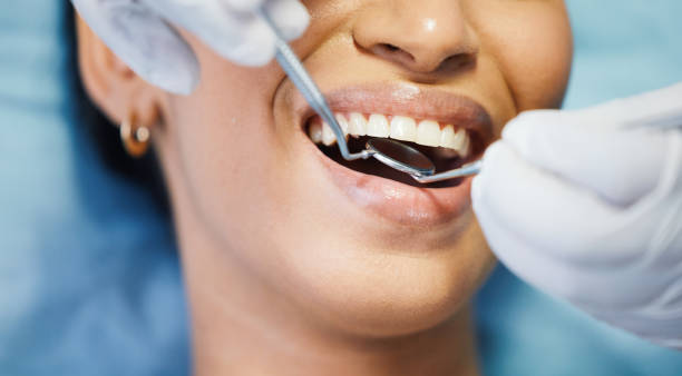 Best Emergency Dentist for Knocked-Out Tooth in Newark, OH